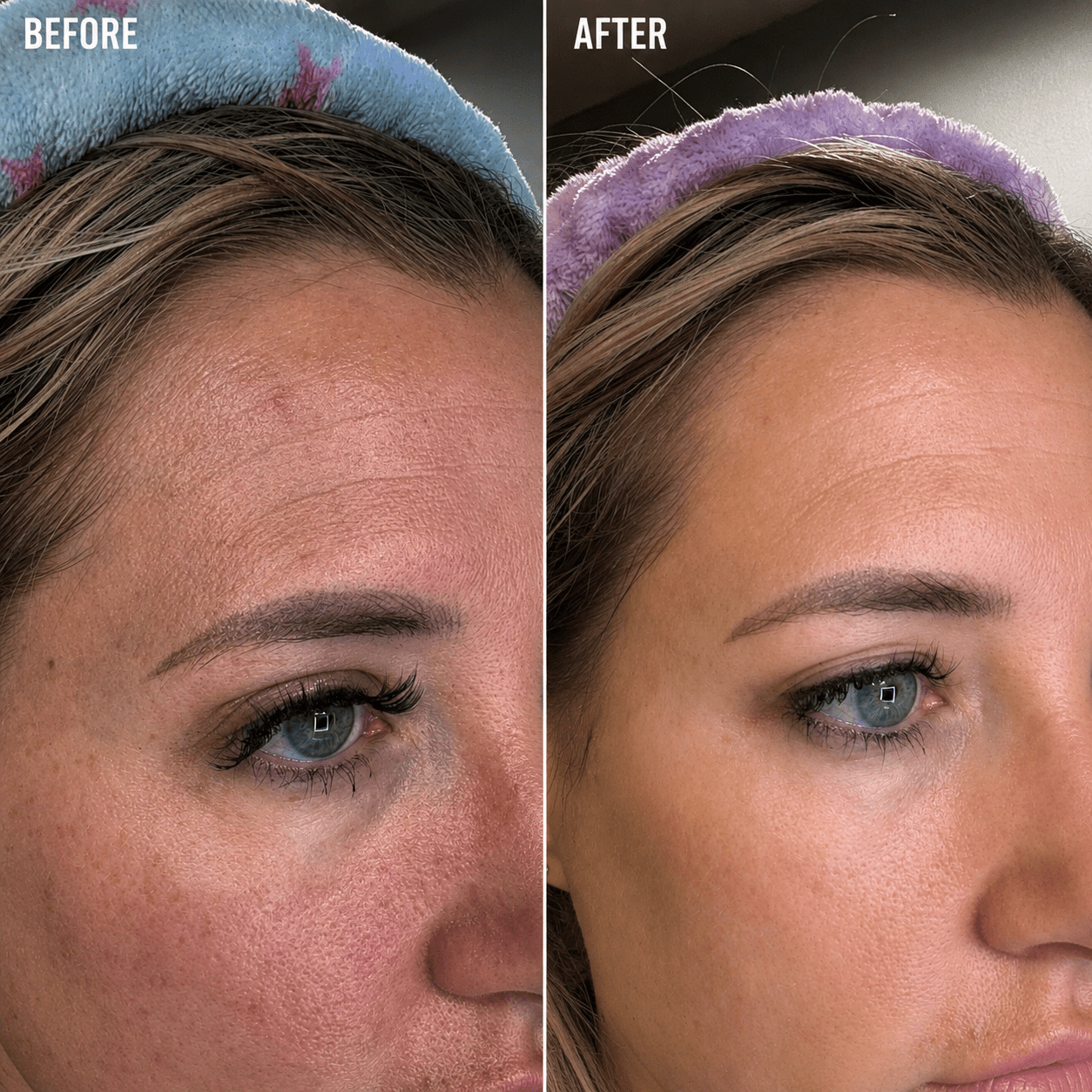 Before and after results using the Protect routine